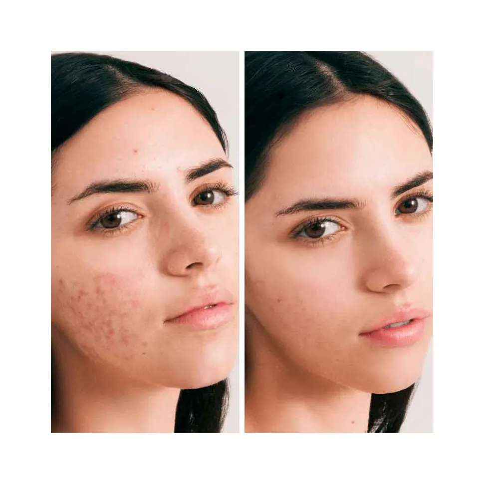 Crema facial hidratante, piel grasa y acné, con CBD, ecológica - Herbera Biocosmética